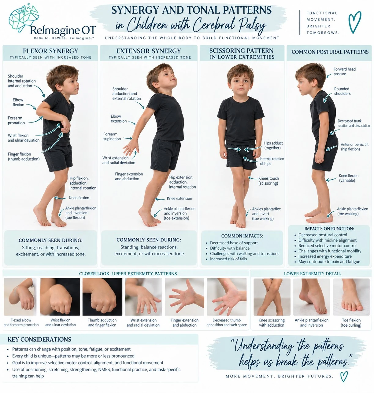 Synergy and tonal patterns in children with cerebral palsy — whole-body flexor and extensor packages, scissoring, and their effect on function.