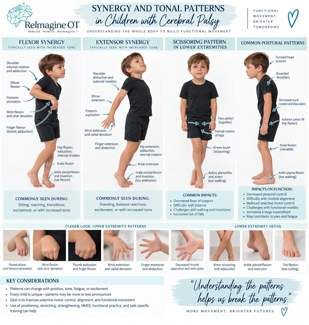 Synergy and Tonal Patterns in Children with Cerebral Palsy: illustrated flexor and extensor synergy patterns, common postural patterns, and functional impacts